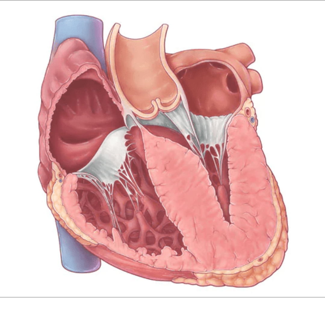 CARDIOMIOPATIA HIPERTRÓFICA